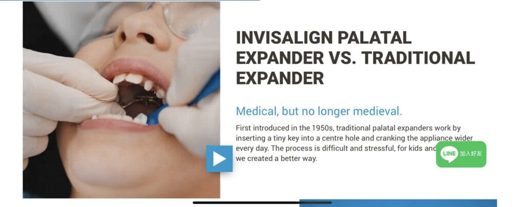 Invisalign advertising