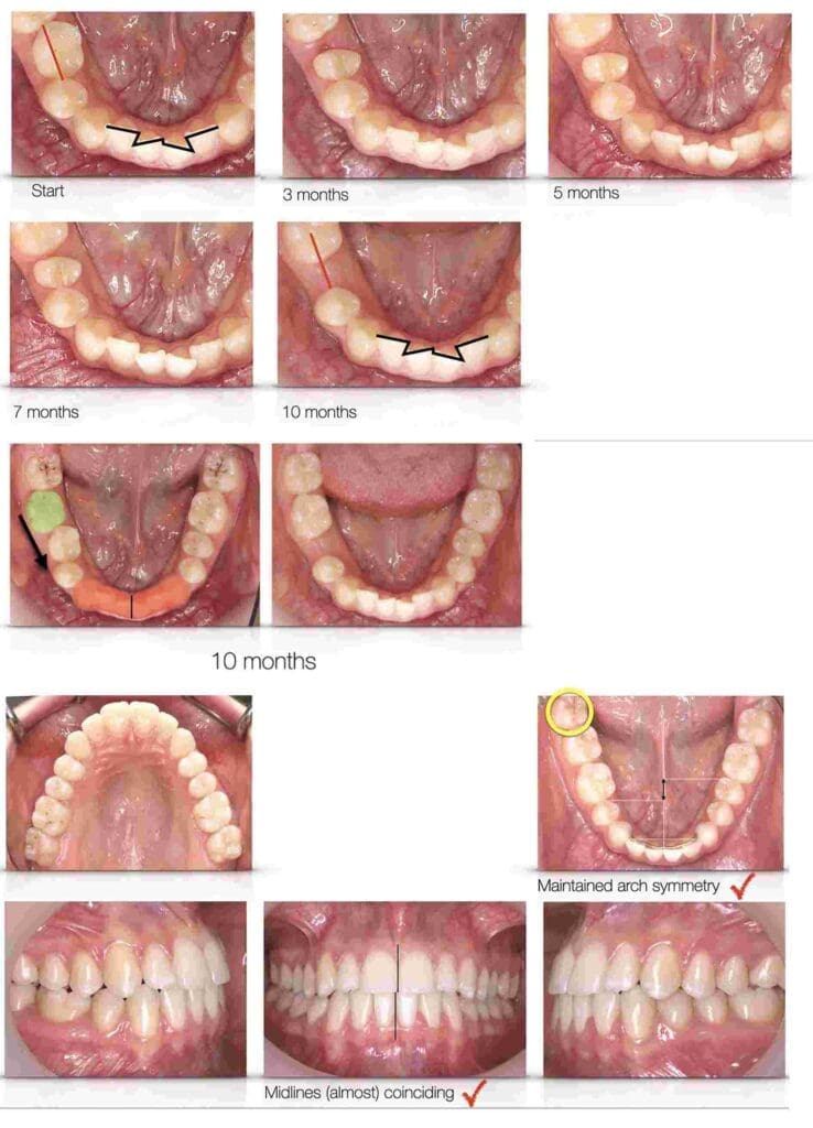 Jorg Figure - Kevin O'Brien's Orthodontic Blog